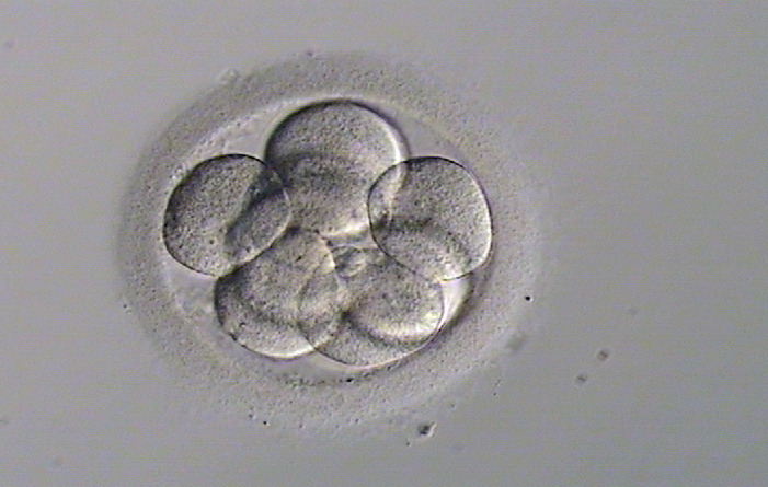 ivf-style-and-life-by-susana